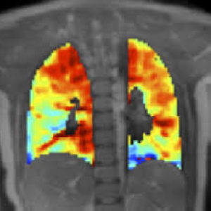non-invasive imaging